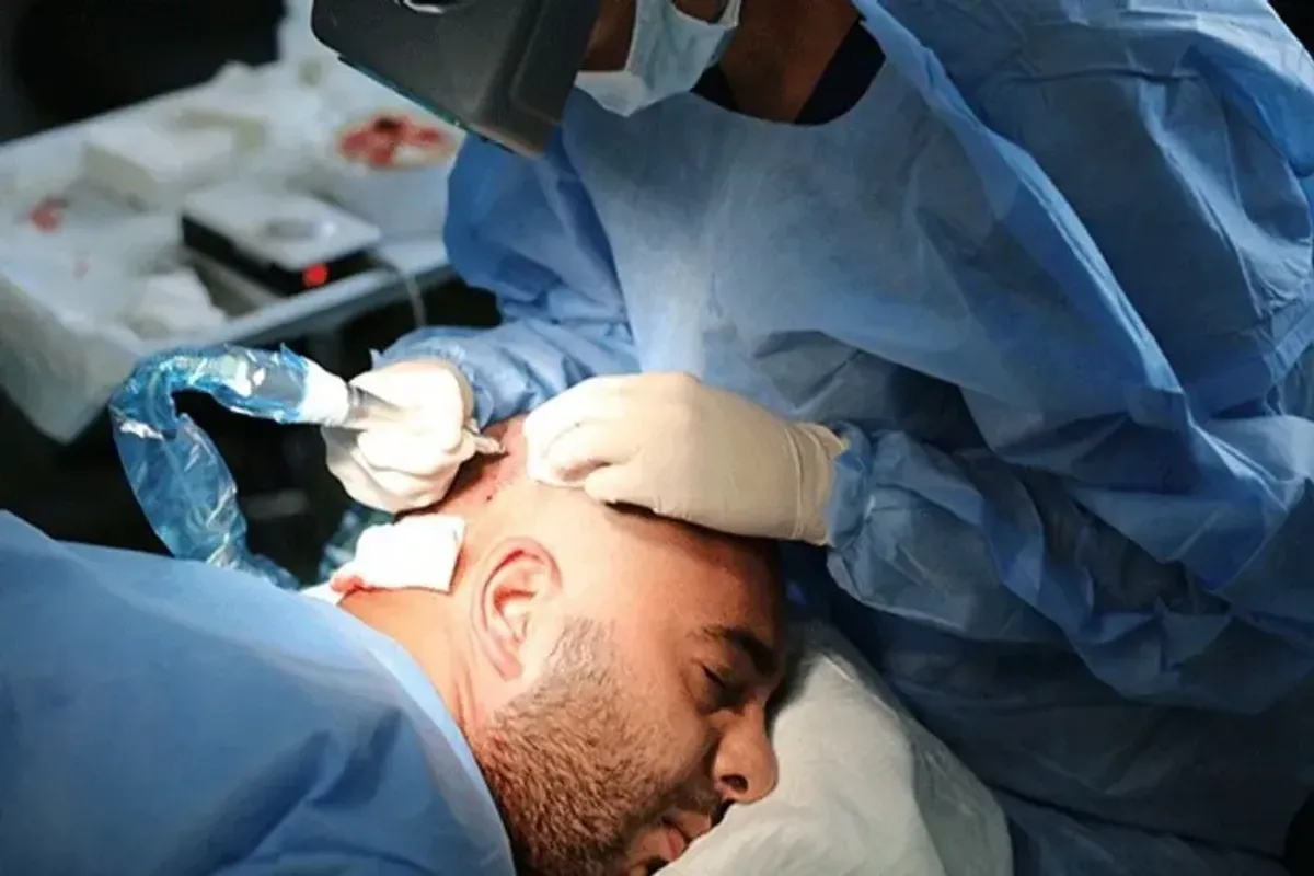 HDC Hair Transplant Clinic, Nicosie, Chypre