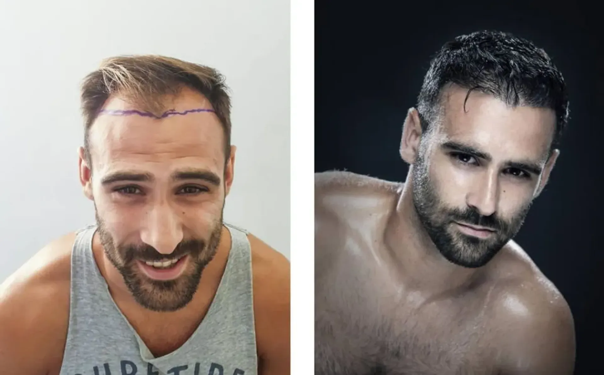 Inluxs Clinics, Ibiza, Barcelona, Madrid, Espagne - Ibiza , Espagne