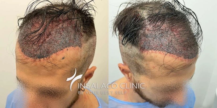 Insalaco clinic, Rome, Italie - Photo 4
