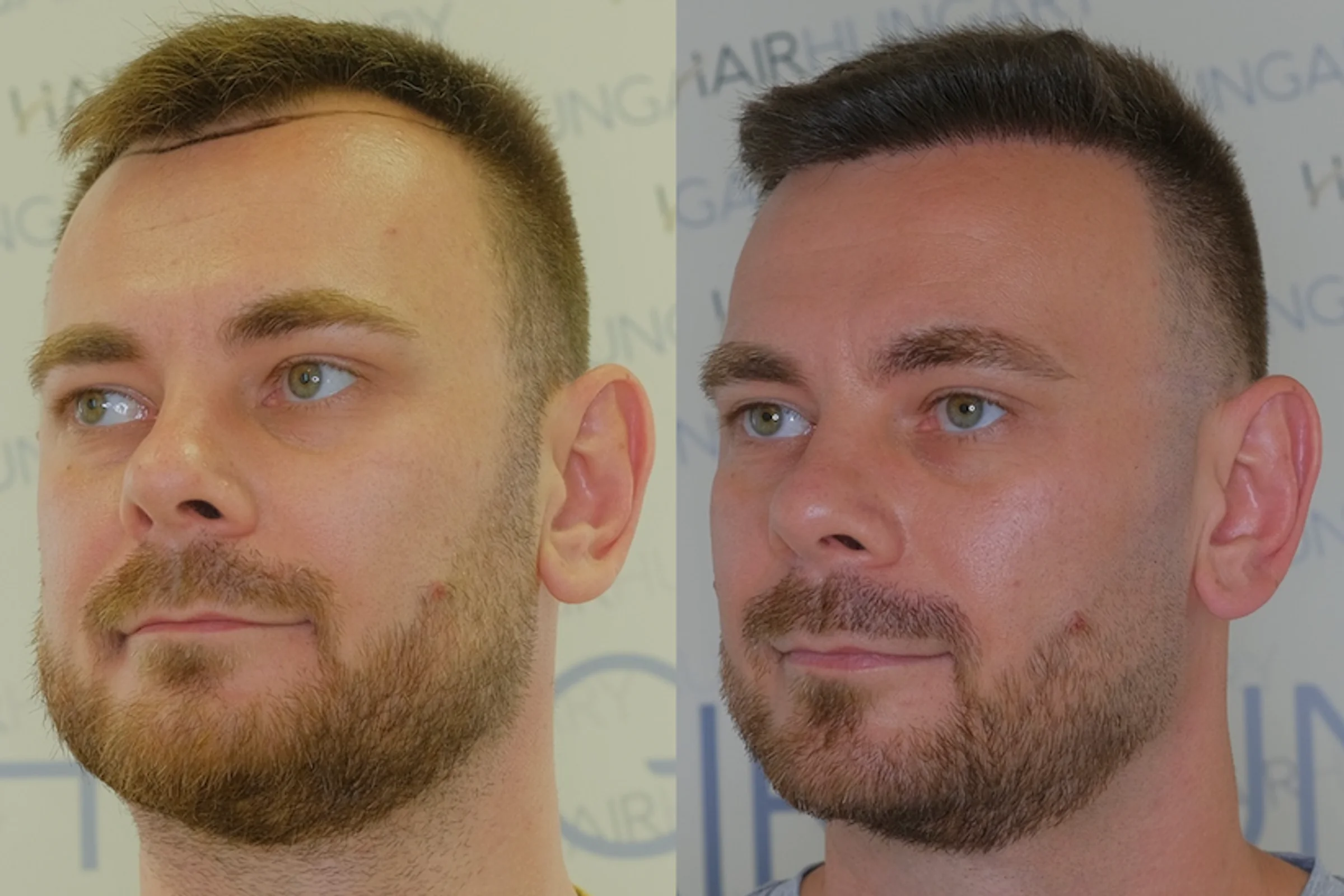 HairHungary, Budapest, Hungría - Photo 1