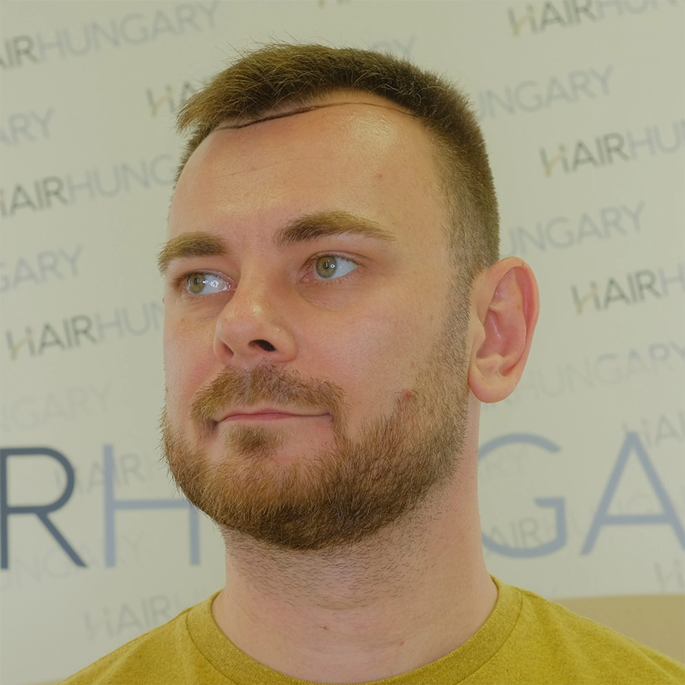 HairHungary, Budapest, Hongrie - Photo 2