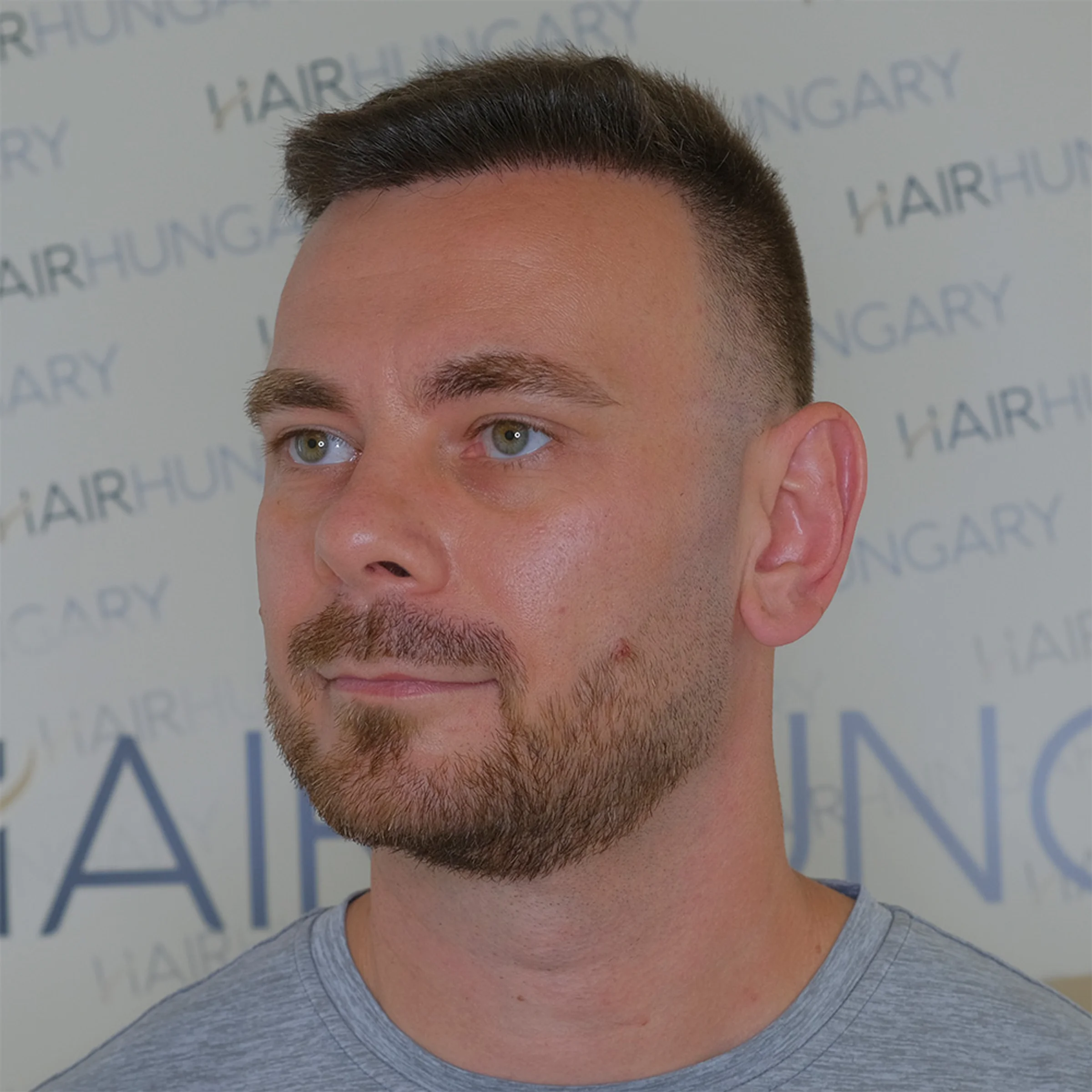 HairHungary, Budapest, Hongrie - Photo 3