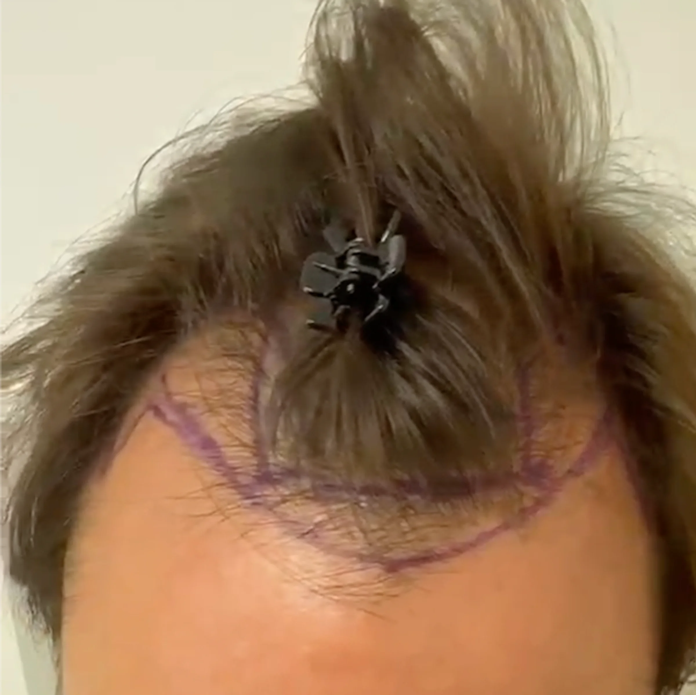 Dr Sabatier, clinique Hexagone, Nice, France - Photo 1