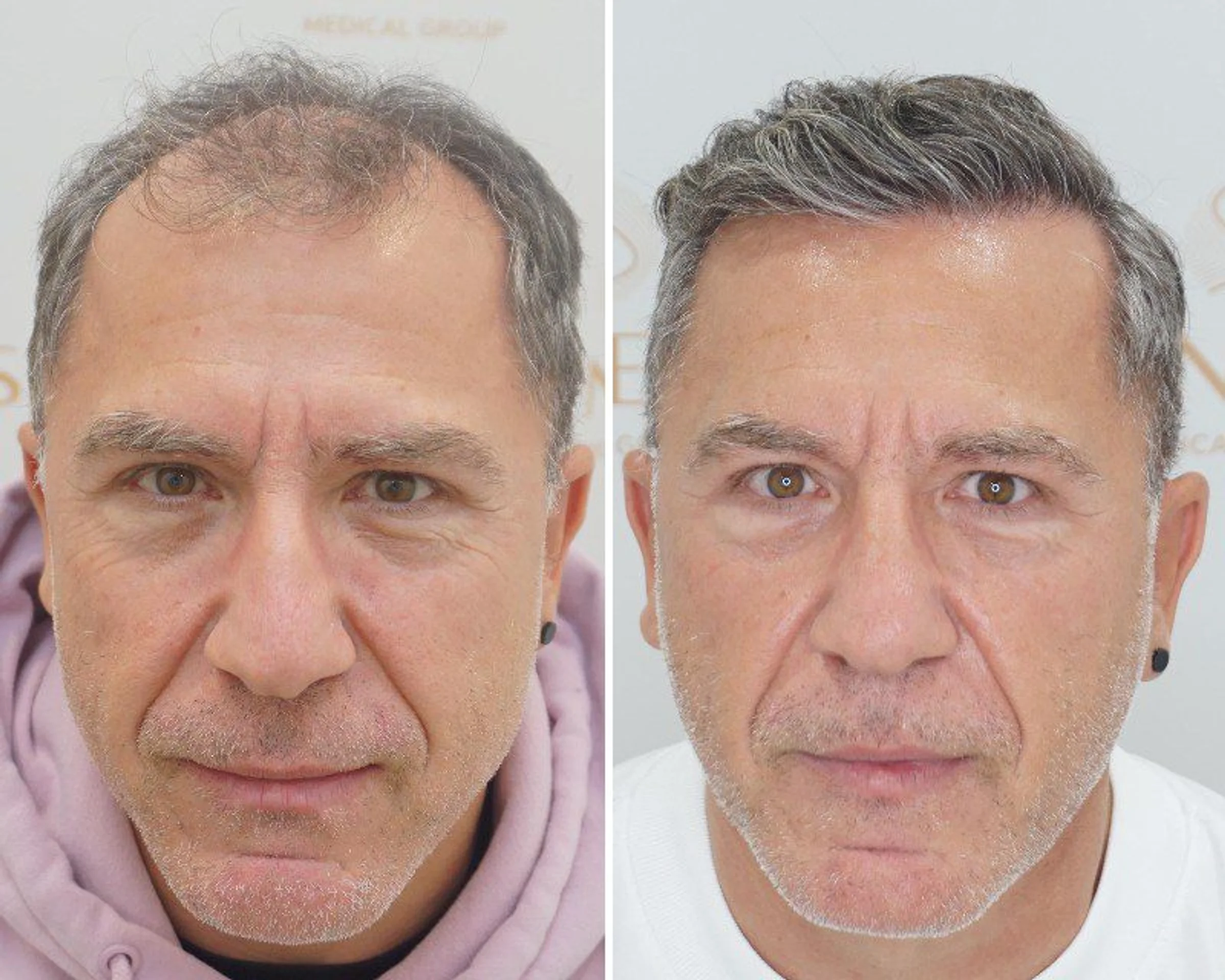 Seneca Medical Group, Grèce - Photo 1