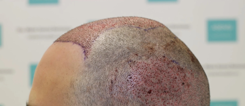 Dr Maria Asensi, Palma de Majorque, Espagne - Photo 2