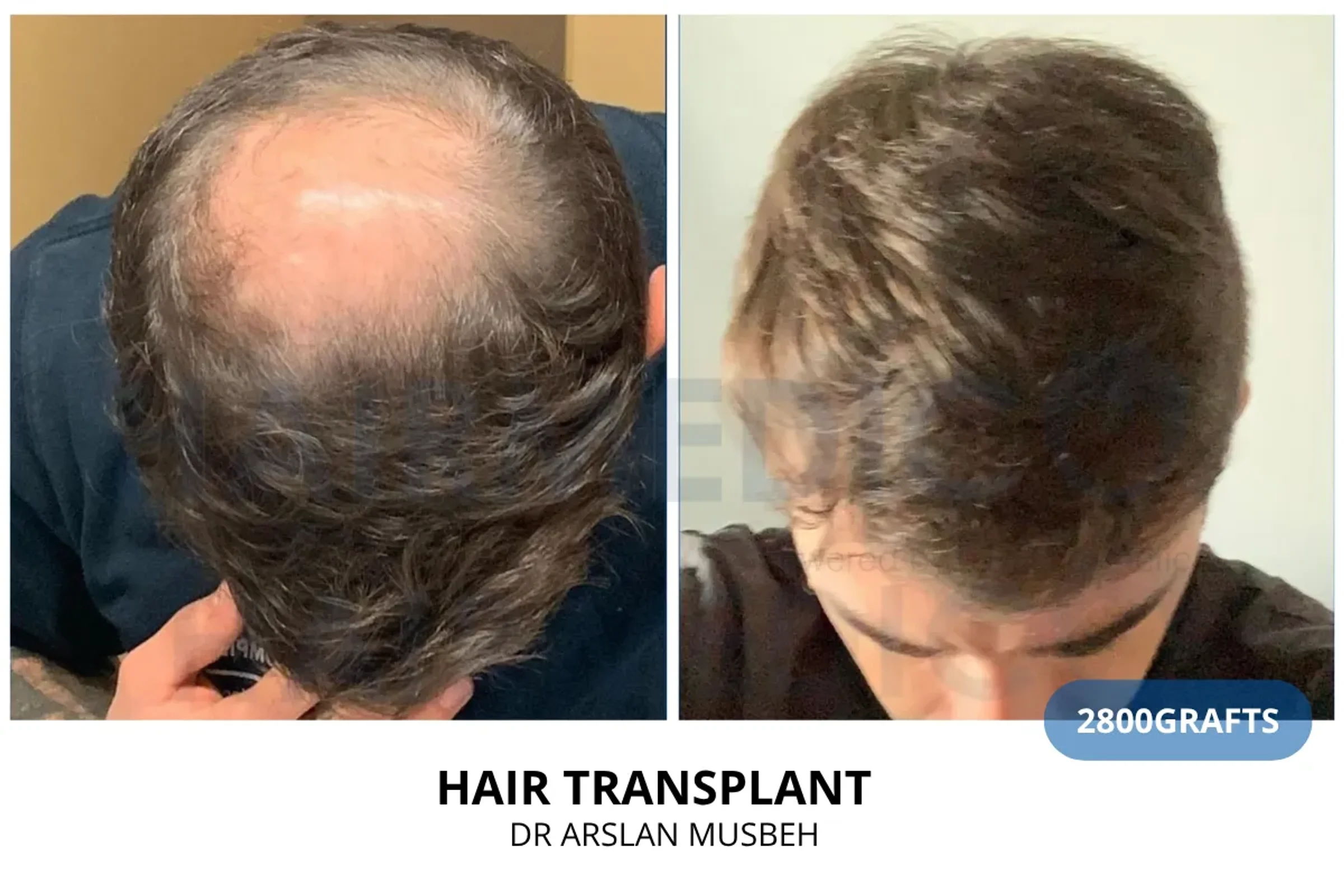 Dr Arslan, HAIRMEDICO, Estambul, Turquía - Photo 1