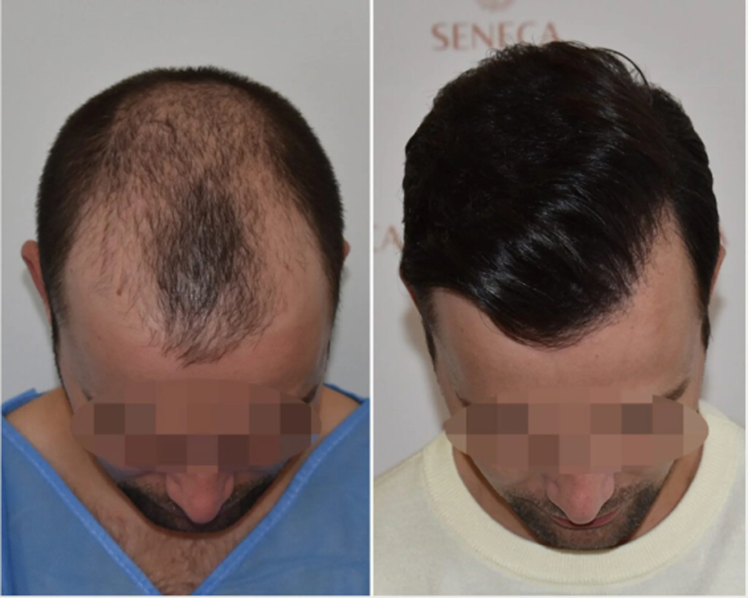 Seneca Medical Group, Grèce - Photo 2