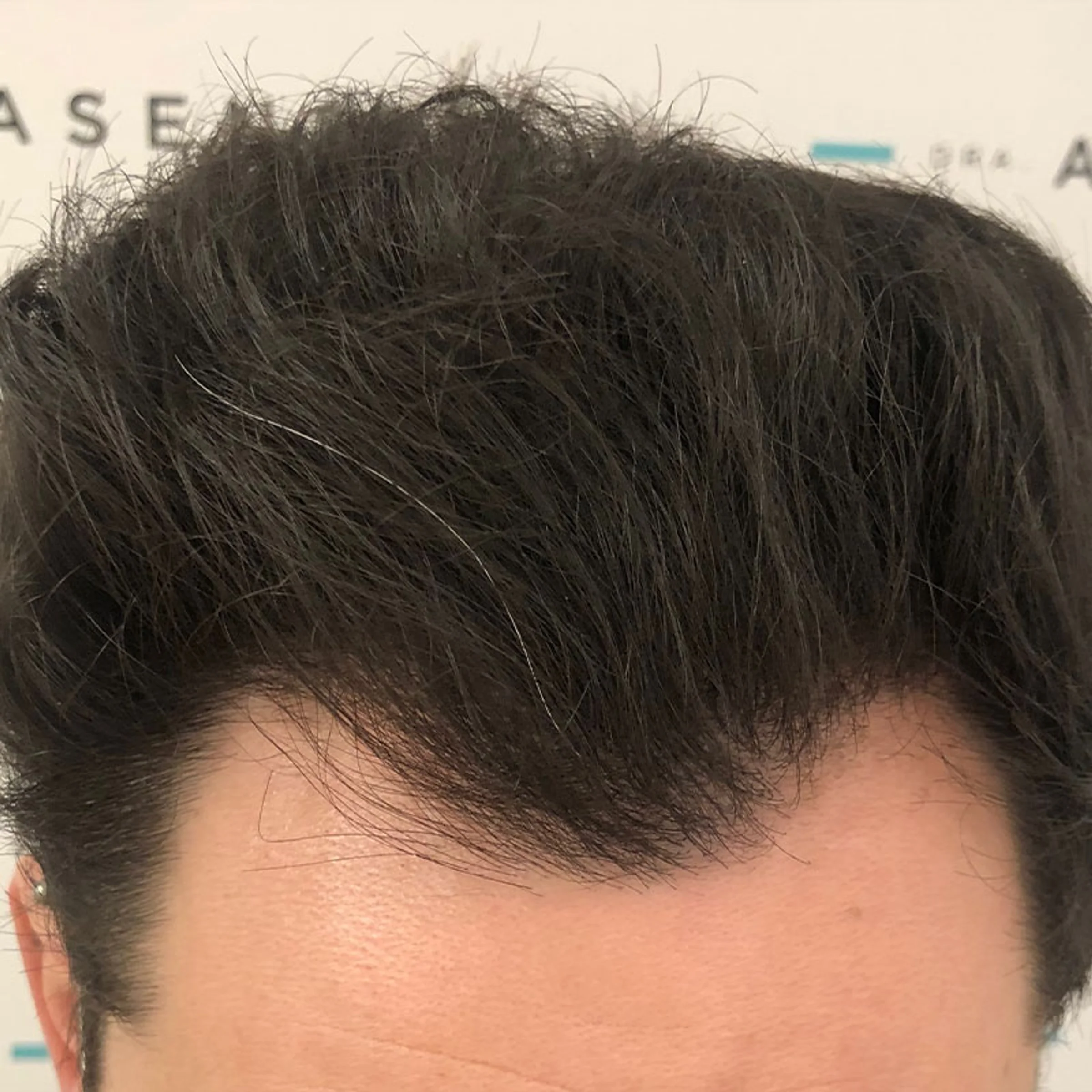 Dra Maria Asensi, Palma de Mallorca, España - Photo 3