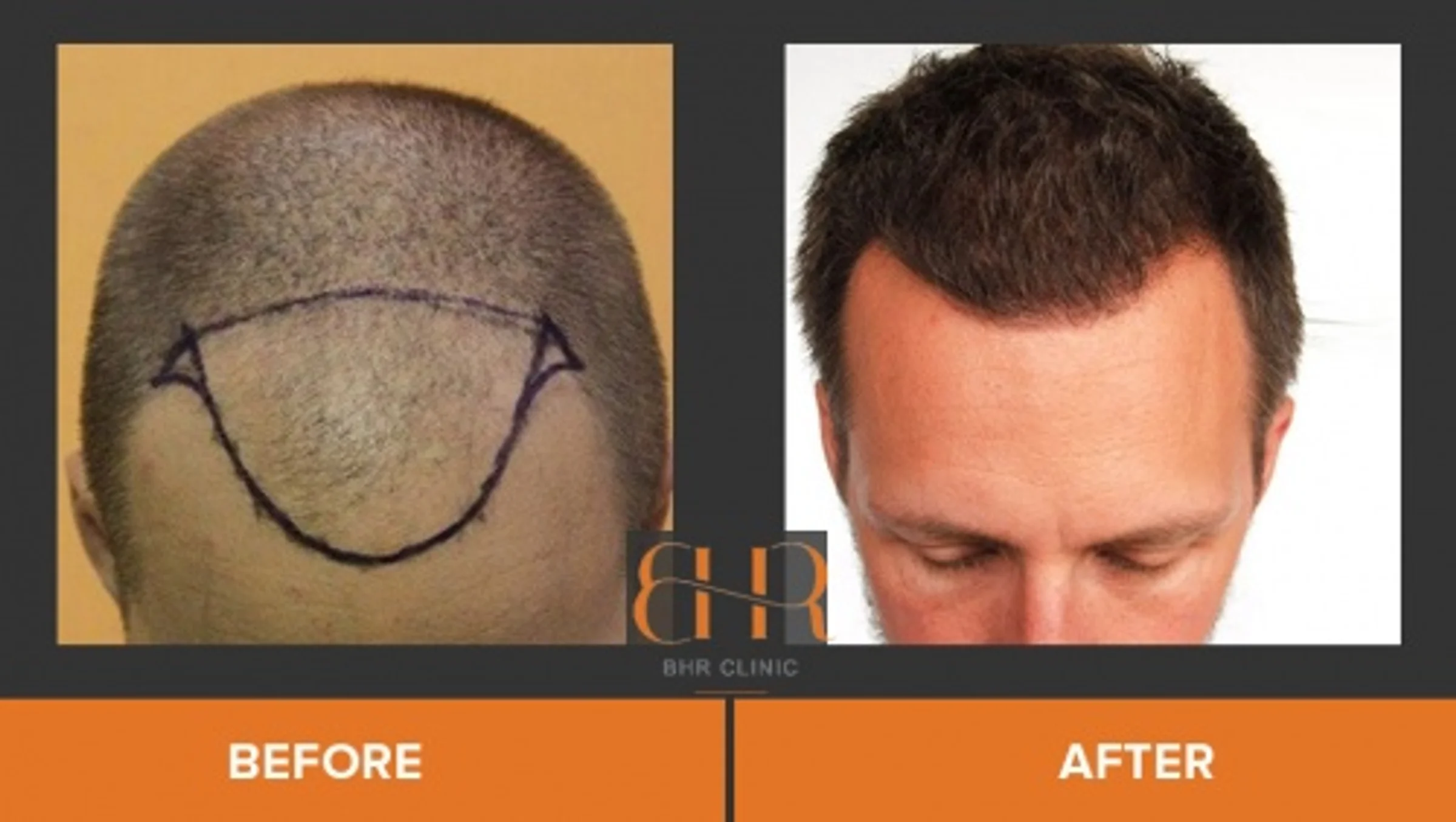 BHR Clinic, Dr Bisanga, Brussels, Belgium - Photo 2