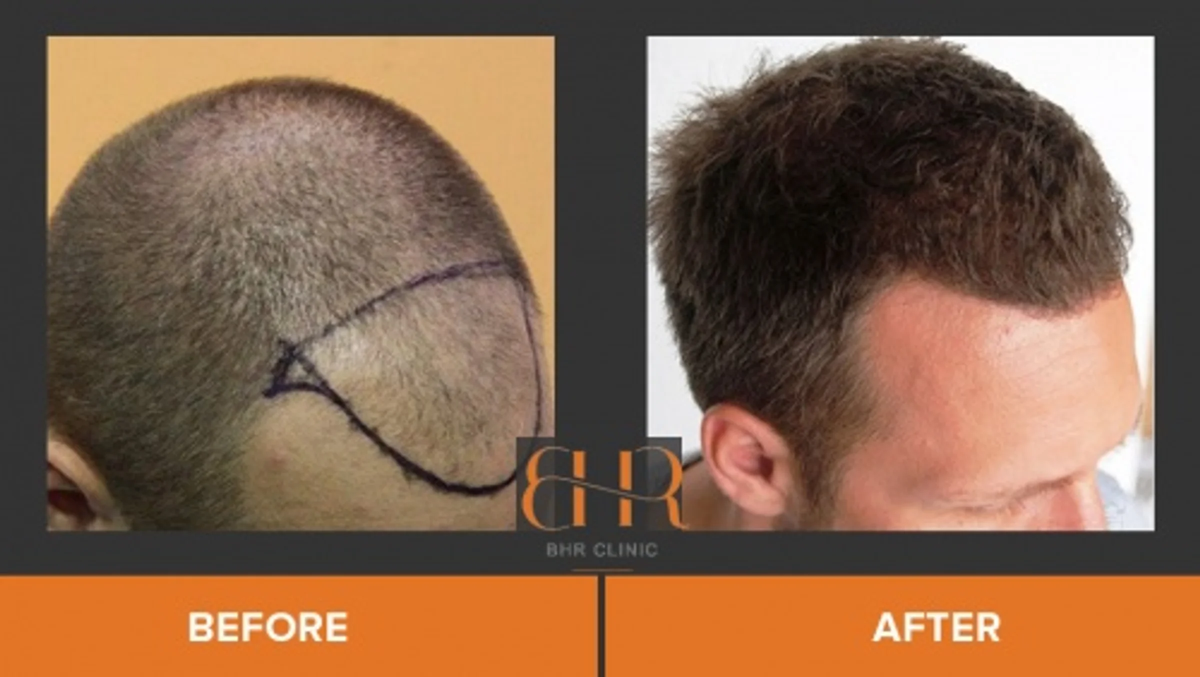 BHR Clinic, Dr Bisanga, Brussels, Belgium - Photo 3