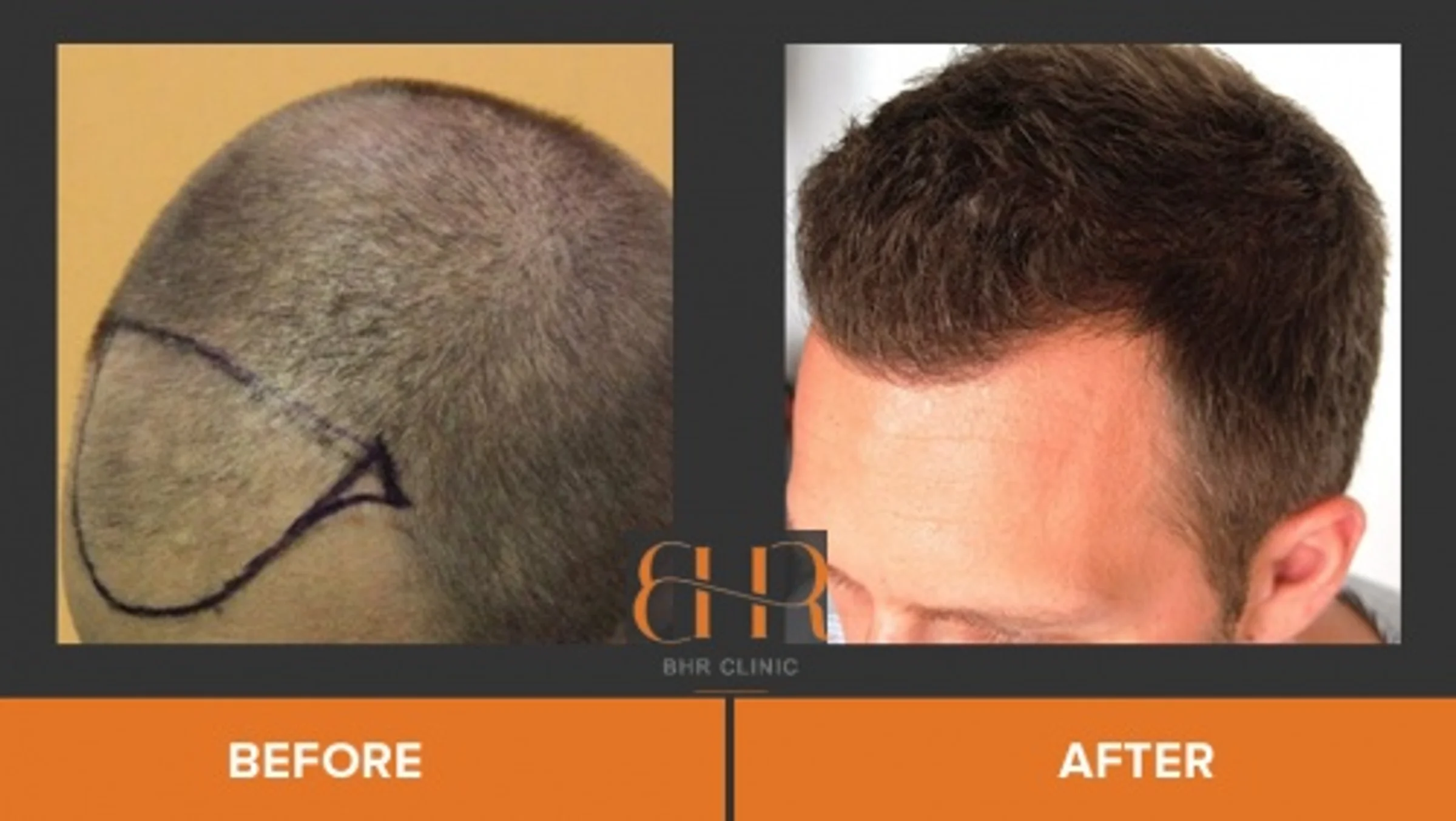 BHR Clinic, Dr Bisanga, Bruselas, Bélgica - Photo 4