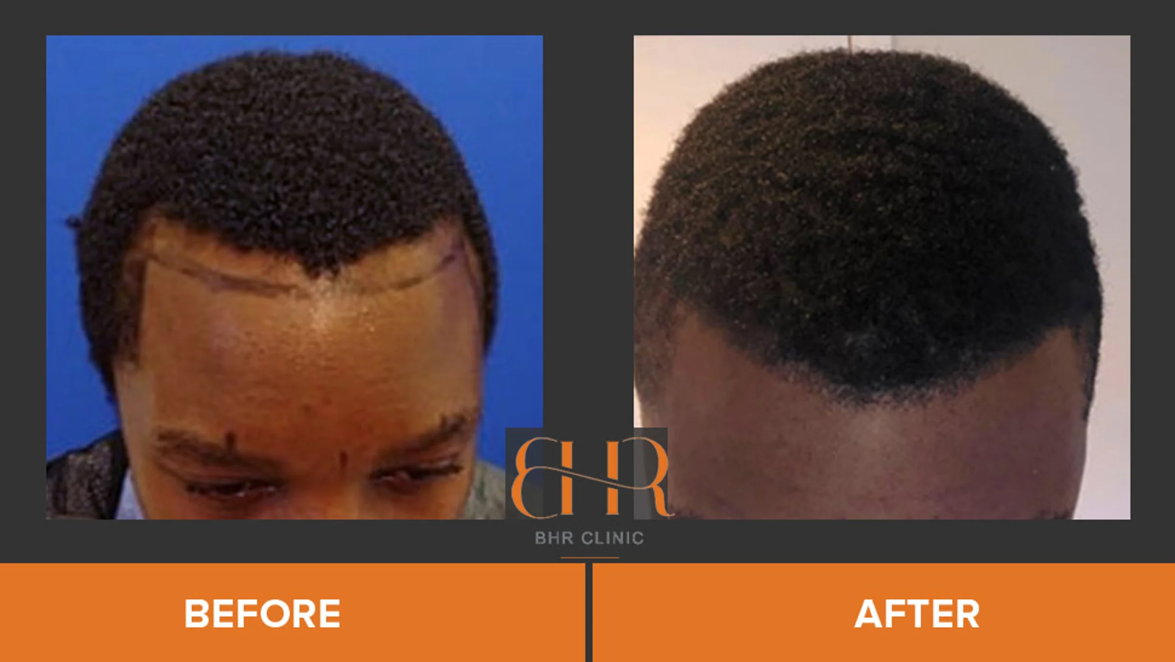 BHR Clinic, Dr Bisanga, Bruselas, Bélgica - Photo 1