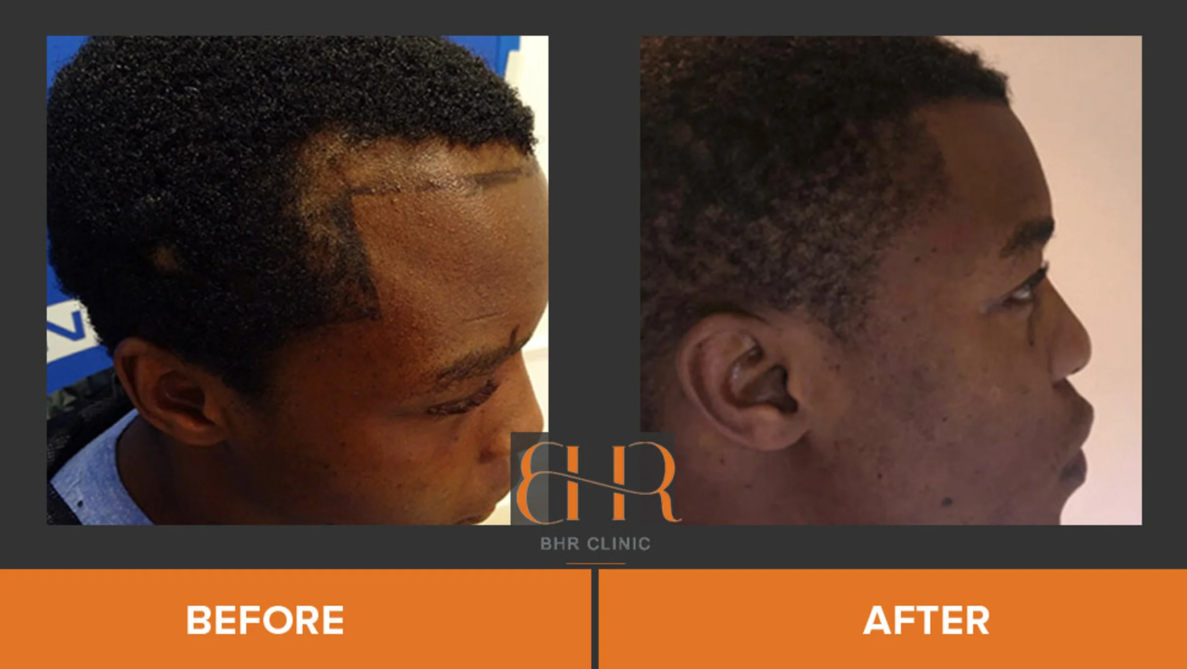 BHR Clinic, Dr Bisanga, Bruxelles, Belgique - Photo 2