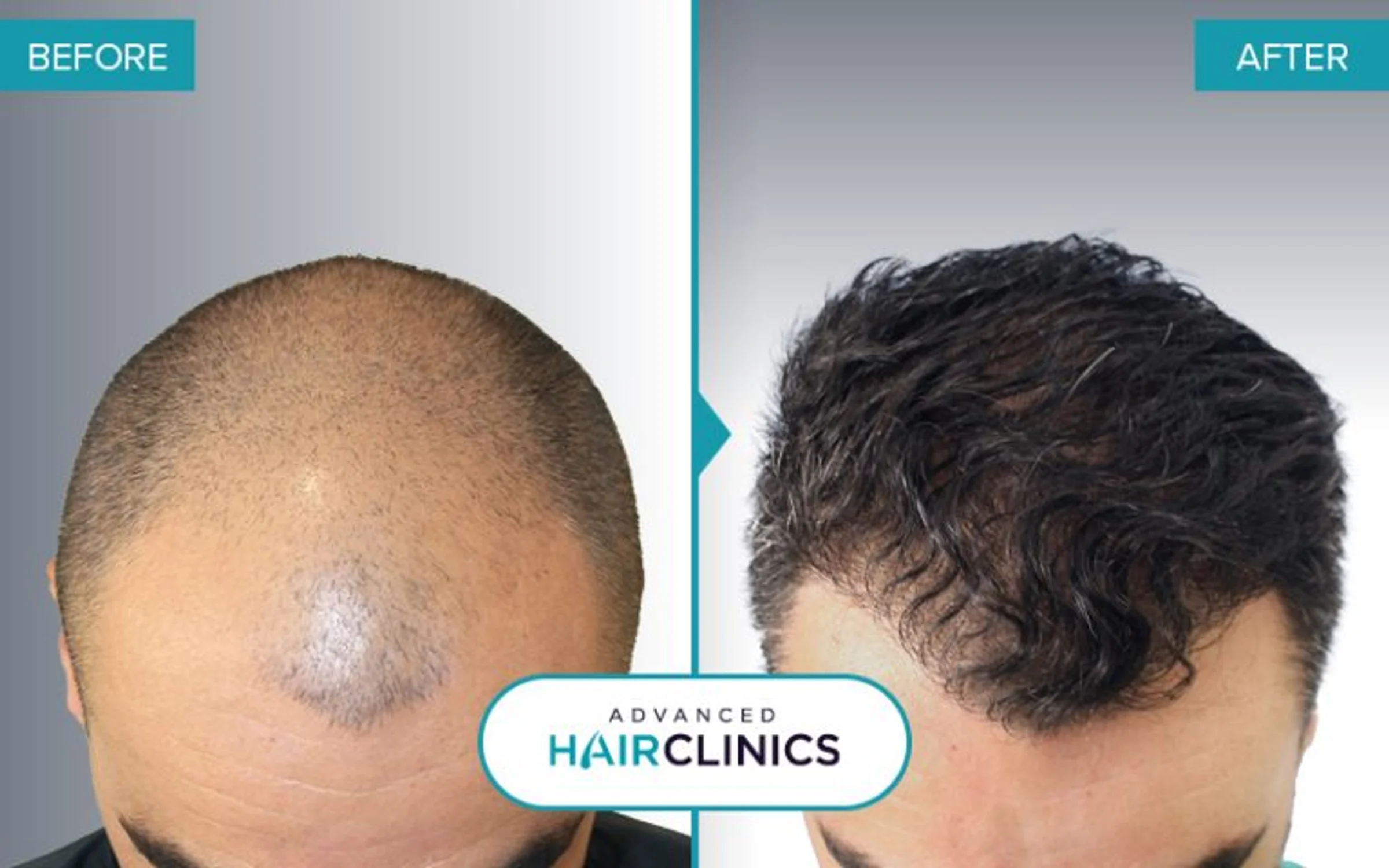 Advanced Hair Clinics, Athens, Greece - Photo 1