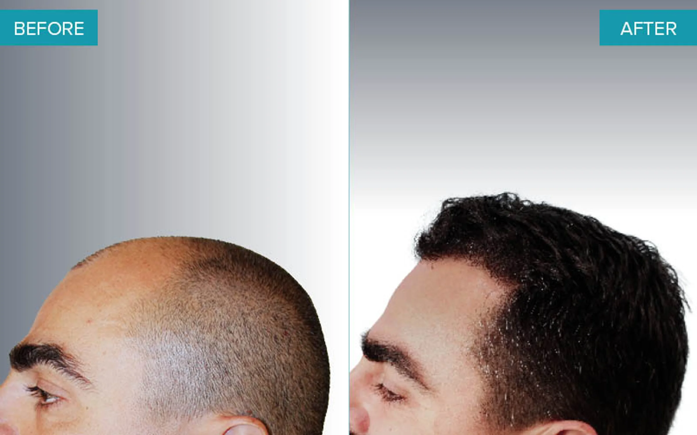 Advanced Hair Clinics, Athens, Greece - Photo 2