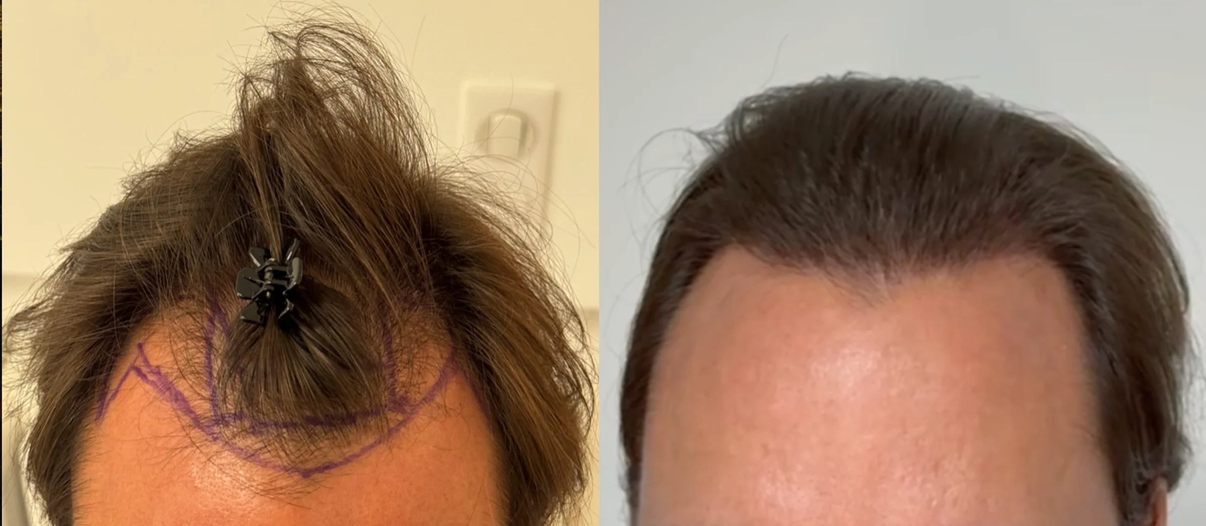 Dr Sabatier, Hexagone clinic, Nice, France - Photo 1