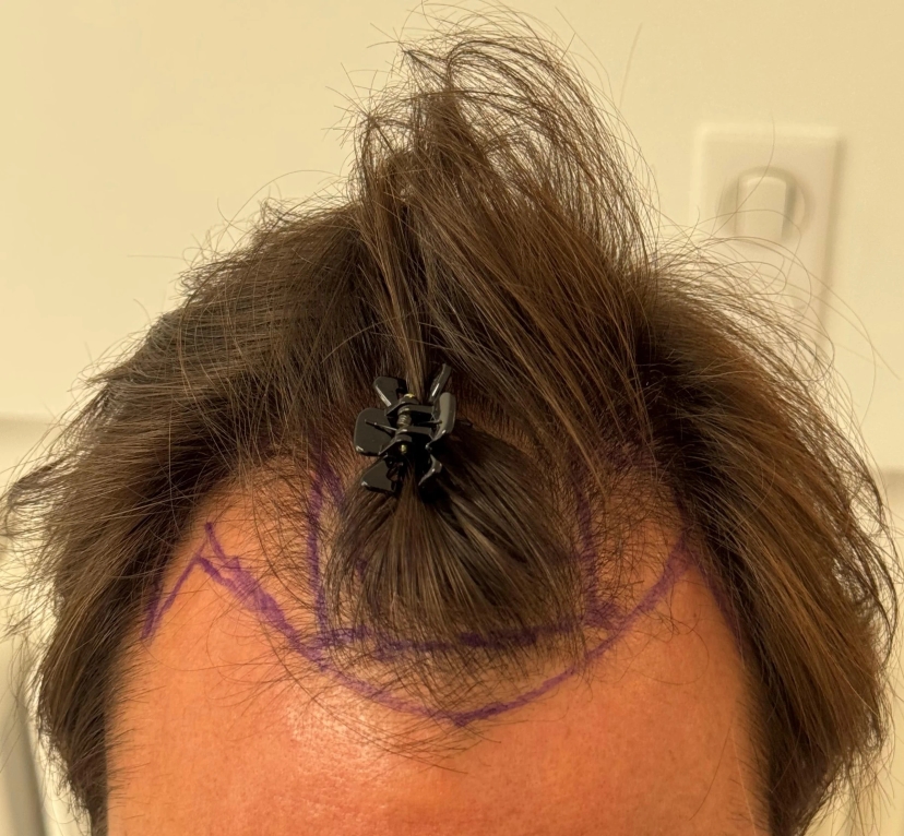 Dr Sabatier, Hexagone clinic, Nice, France - Photo 2