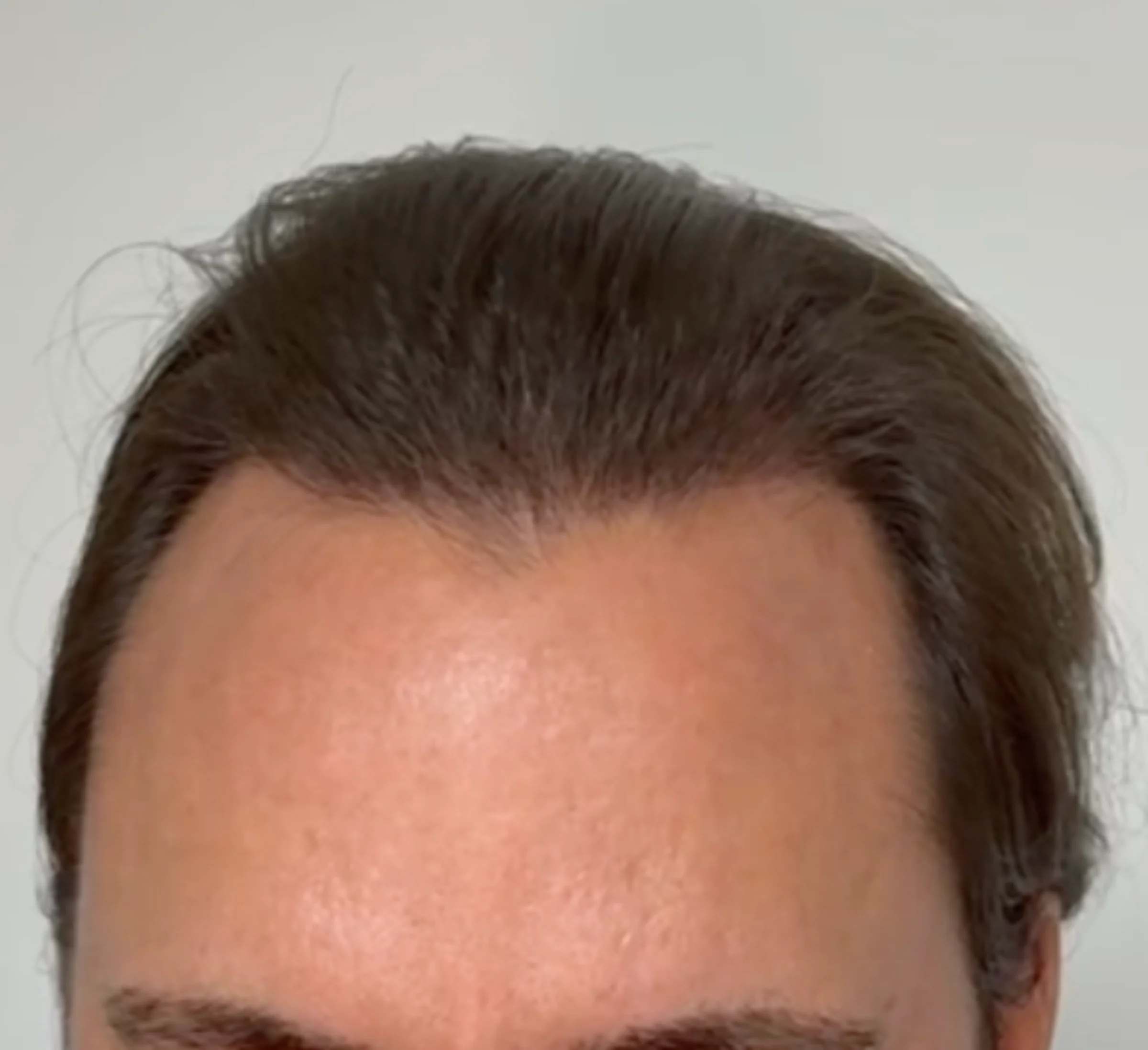 Dr Sabatier, Hexagone clinic, Nice, France - Photo 3