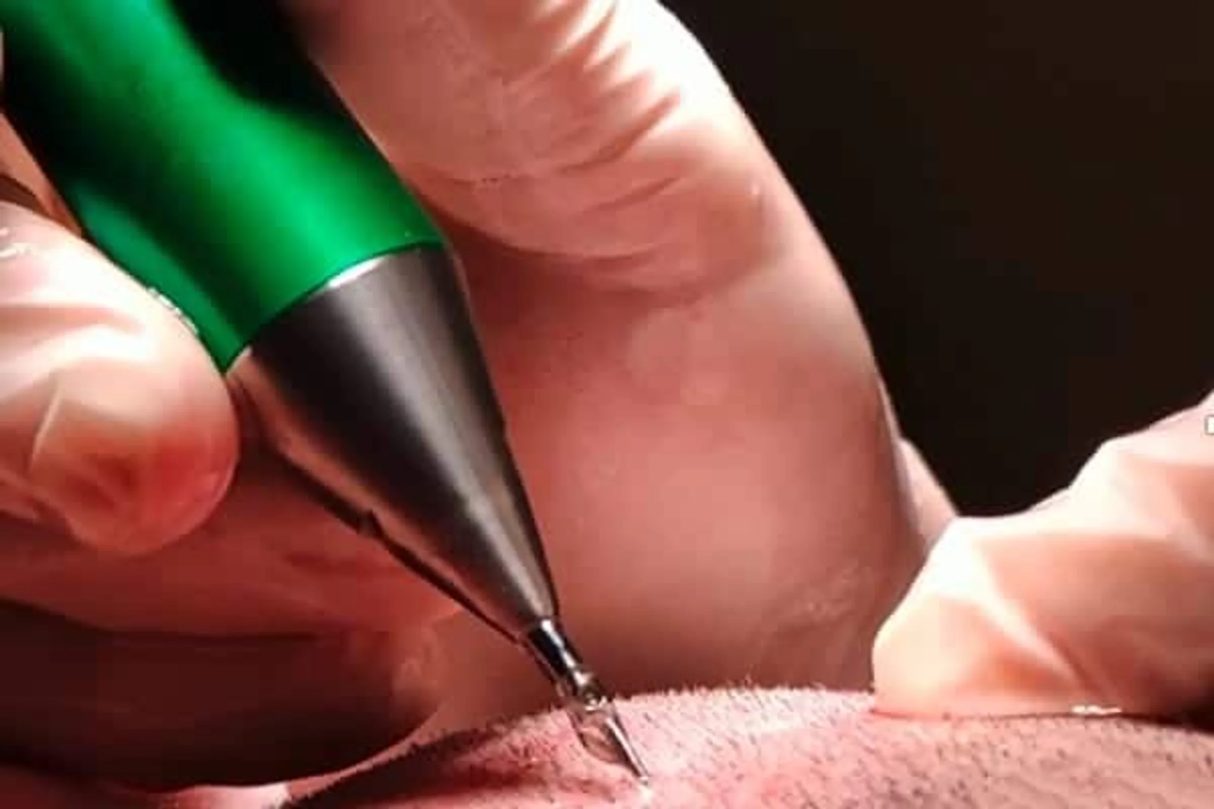 Dr. Joren Brassine, The Clinic, Brussels, Belgium - Photo 1