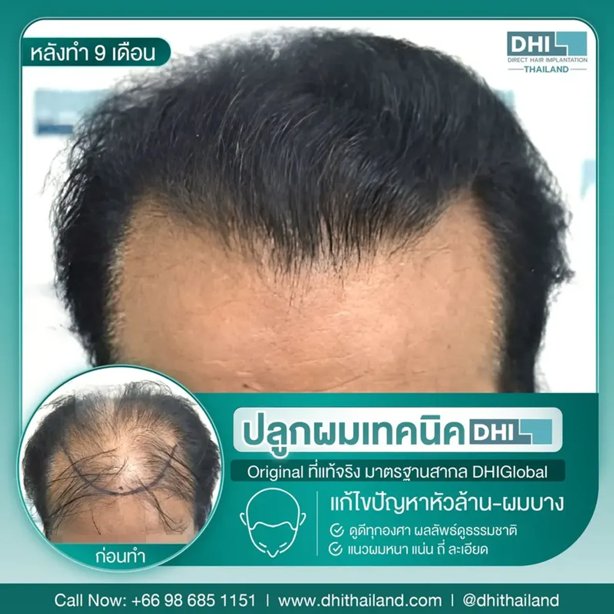 DHI Thailand, Bangkok, Tailandia - Photo 1