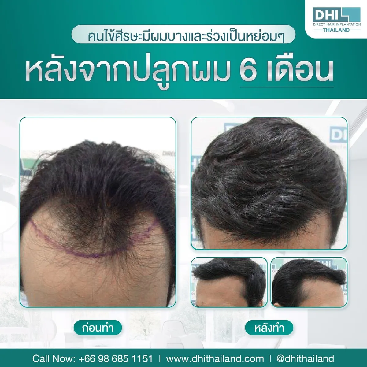 DHI Thailand, Bangkok, Tailandia - Photo 7