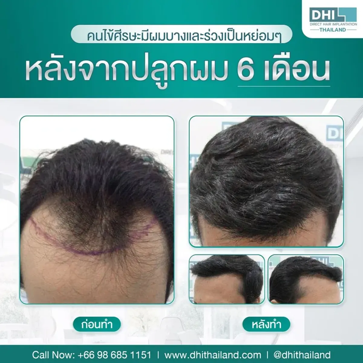 DHI Thailand, Bangkok, Thaïlande - Photo 3