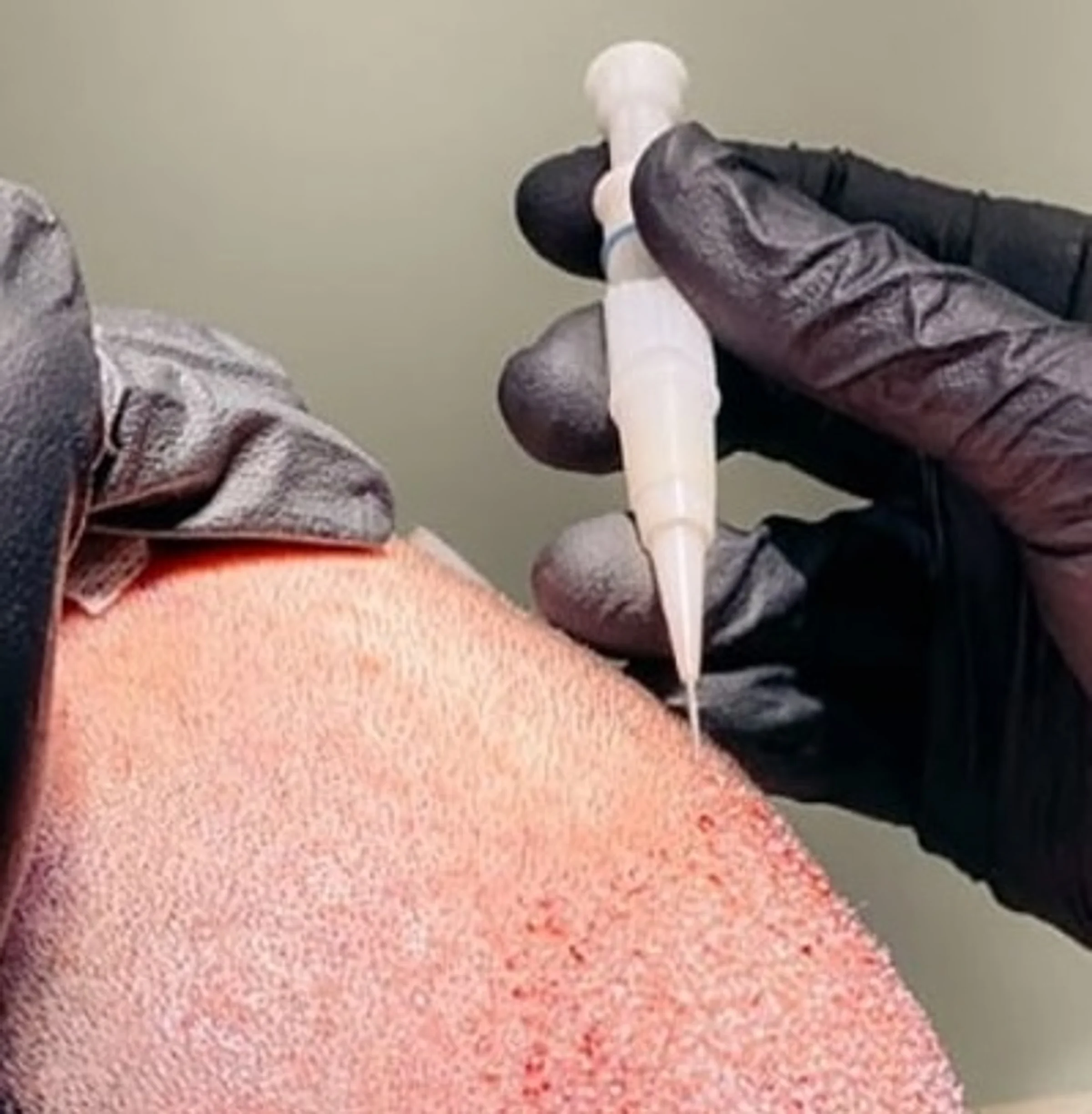 Antiagers Regrow Clinic, Athens, Greece - Photo 2