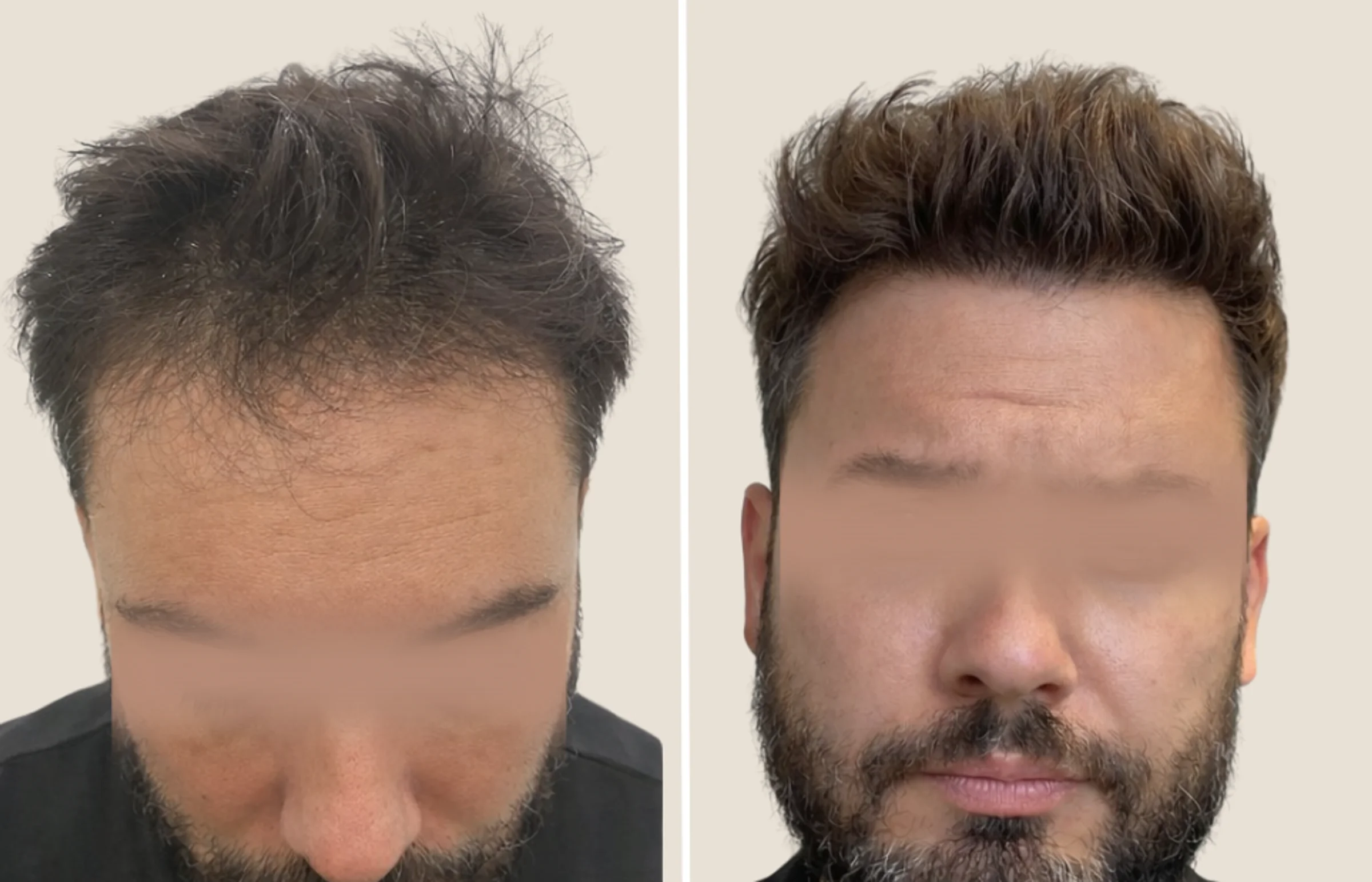 Cliique de Monsieur, Atenas, Grecia - Photo 1