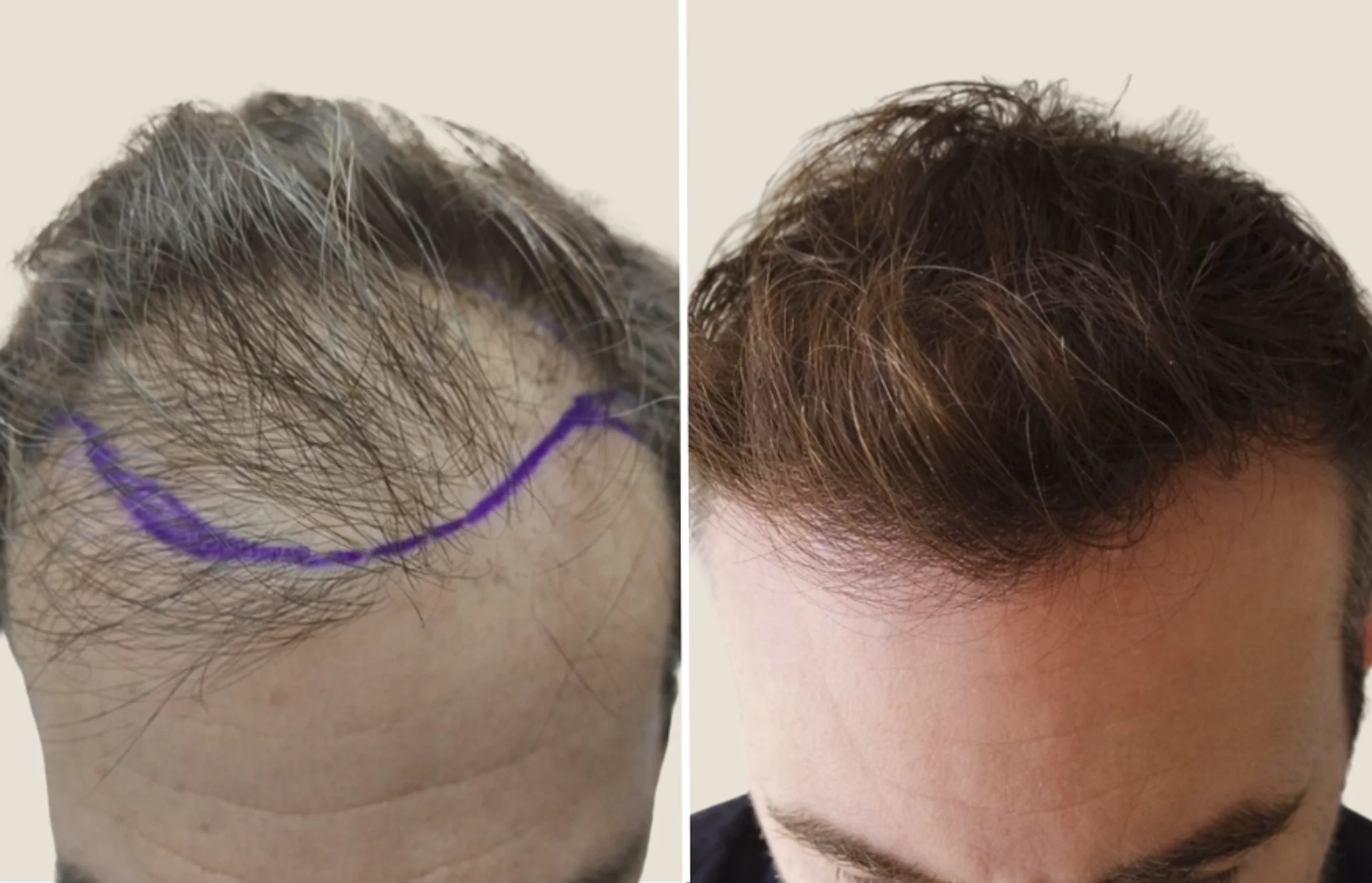 Cliique de Monsieur, Atenas, Grecia - Photo 2