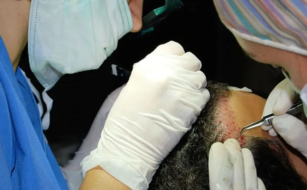 Clinica Capilae, Madrid, Espagne - Photo 3